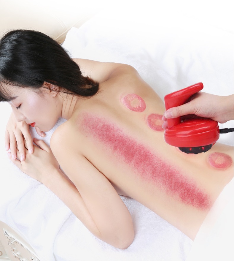 Máy Massage Giác Hơi Điện Tử Máy Massage Giác Hơi Điện Tử