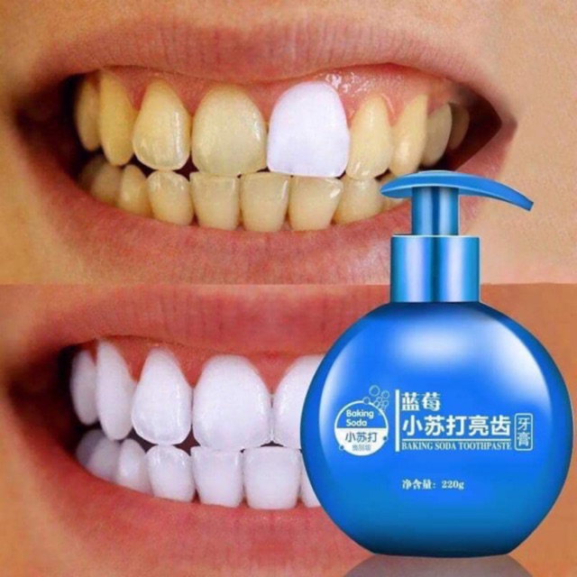 Kem Đánh Răng Baking Soda 220g Kem Đánh Răng Baking Soda 220g