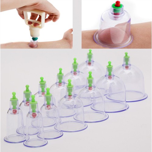 Bộ Dụng Cụ Giác Hơi 12 Ly Không Dùng Lửa Tiện Dụng Bộ Dụng Cụ Giác Hơi 12 Ly Không Dùng Lửa Tiện Dụng