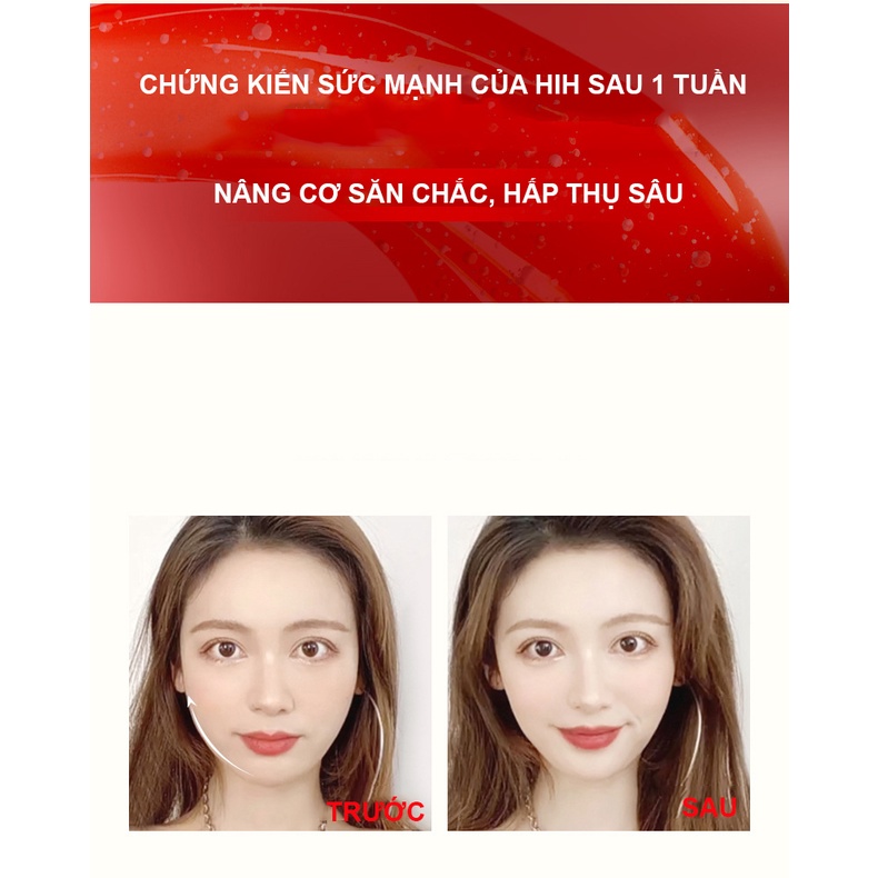 Máy Massage Nâng Cơ Làm Căng Da Mặt Hih Máy Massage Nâng Cơ Làm Căng Da Mặt Hih