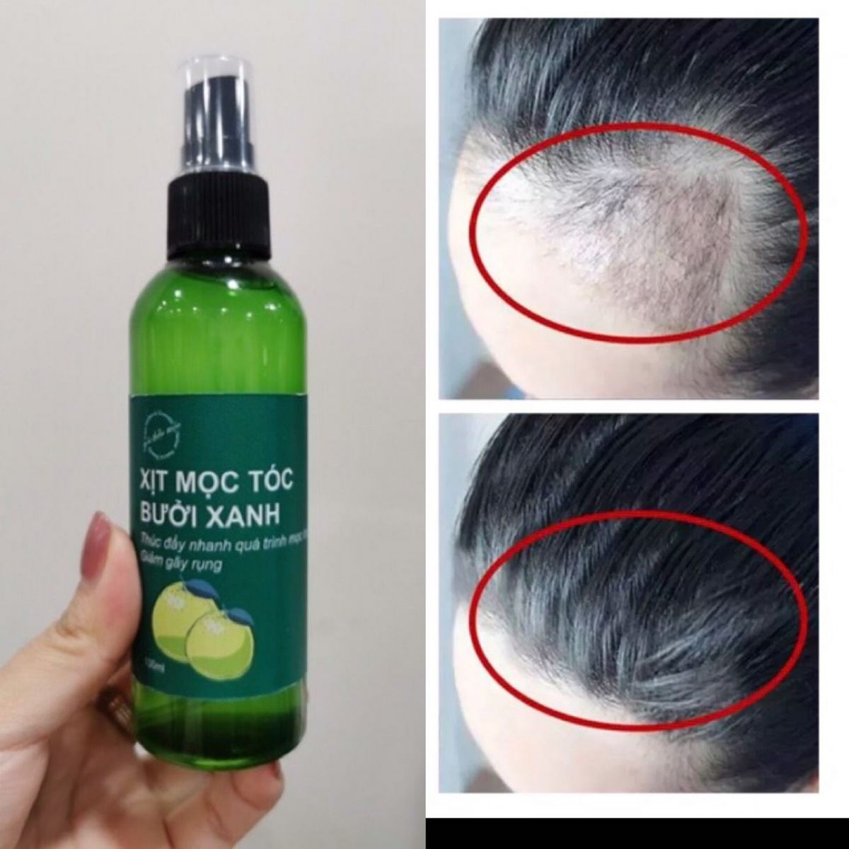 Xịt Mọc Tóc Bưởi Xanh 100Ml Giúp Kích Thích Mọc Tóc (T312) Xịt Mọc Tóc Bưởi Xanh 100Ml Giúp Kích Thích Mọc Tóc (T312)