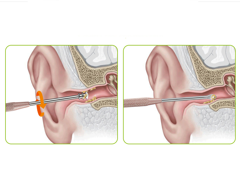 Dụng Cụ Lấy Rái Inox
