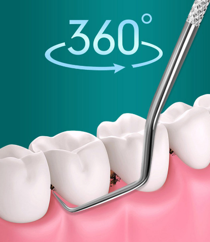 Bộ Dụng Cụ Bằng Inox Giúp Làm Sạch Răng Miệng Bộ Dụng Cụ Bằng Inox Giúp Làm Sạch Răng Miệng